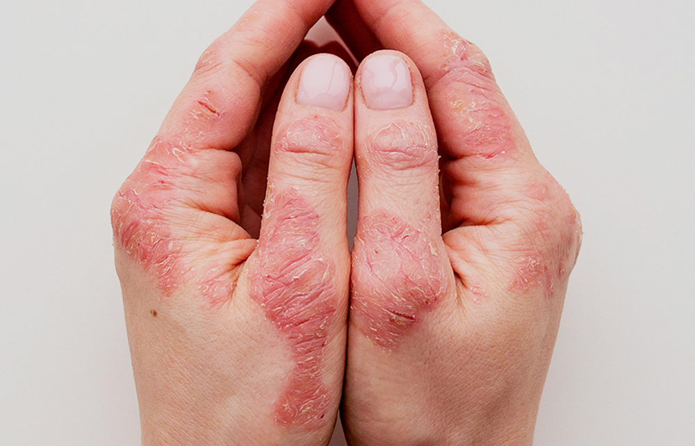 Área Dermotricología y Dermoestética