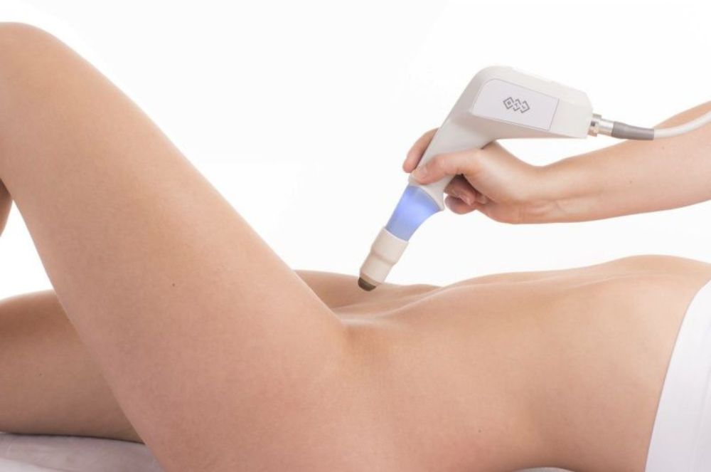 laser vag